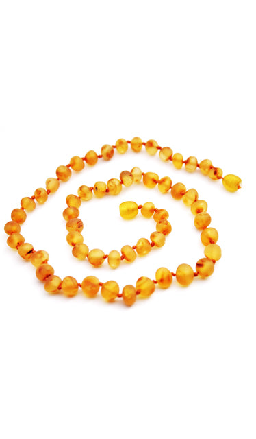 Adult Baroque Baltic Amber Necklace